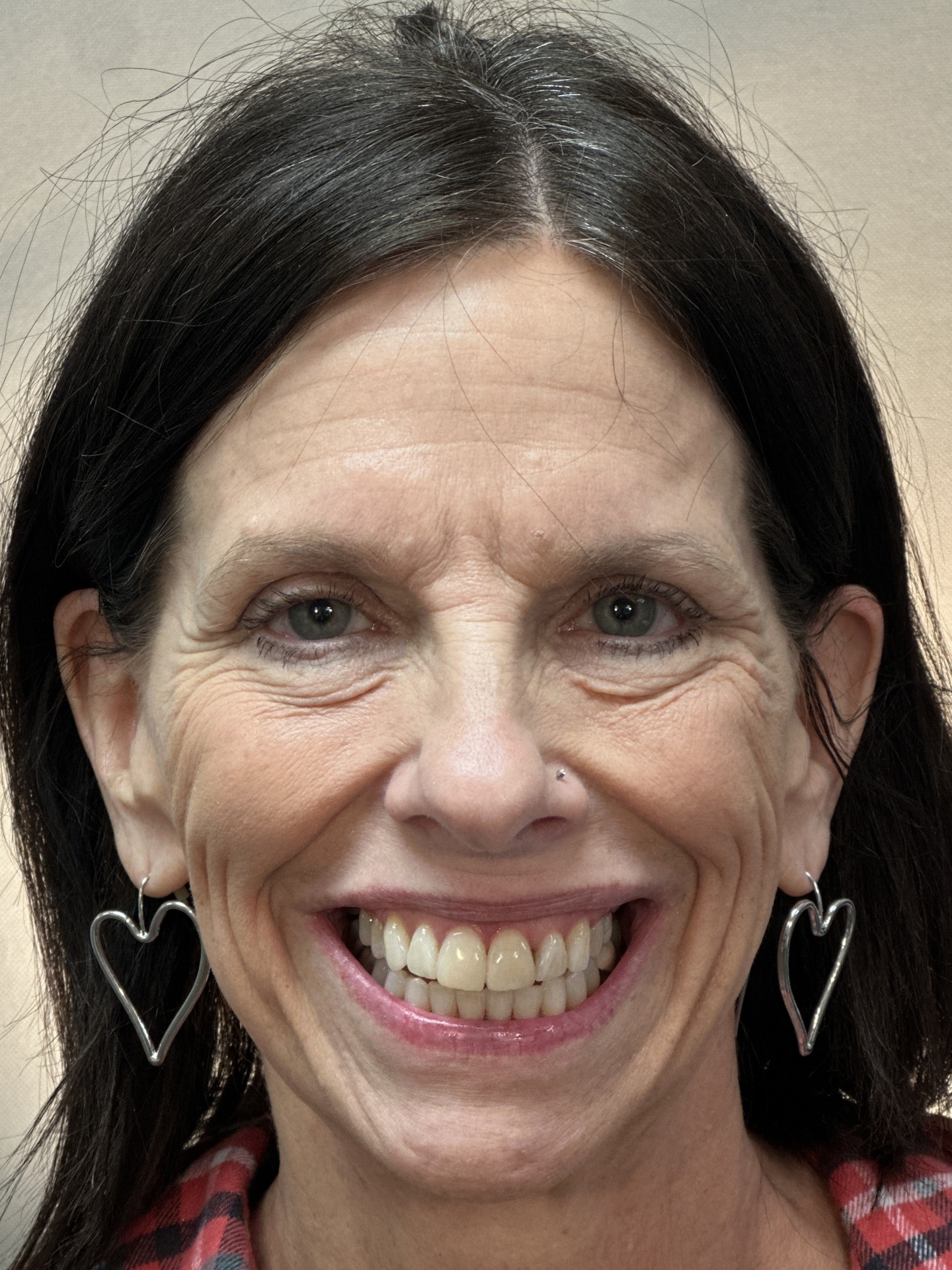 Linda E. smile after treatment at Red Lion Dental