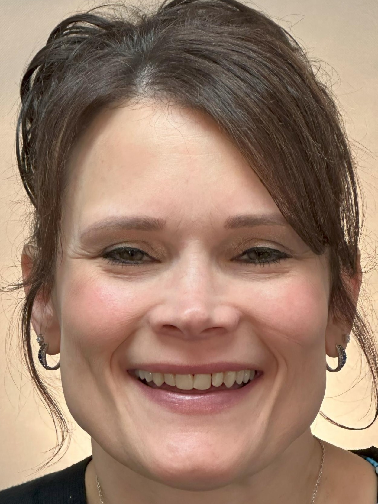 Bobbi W. smile before treatment at Red Lion Dental