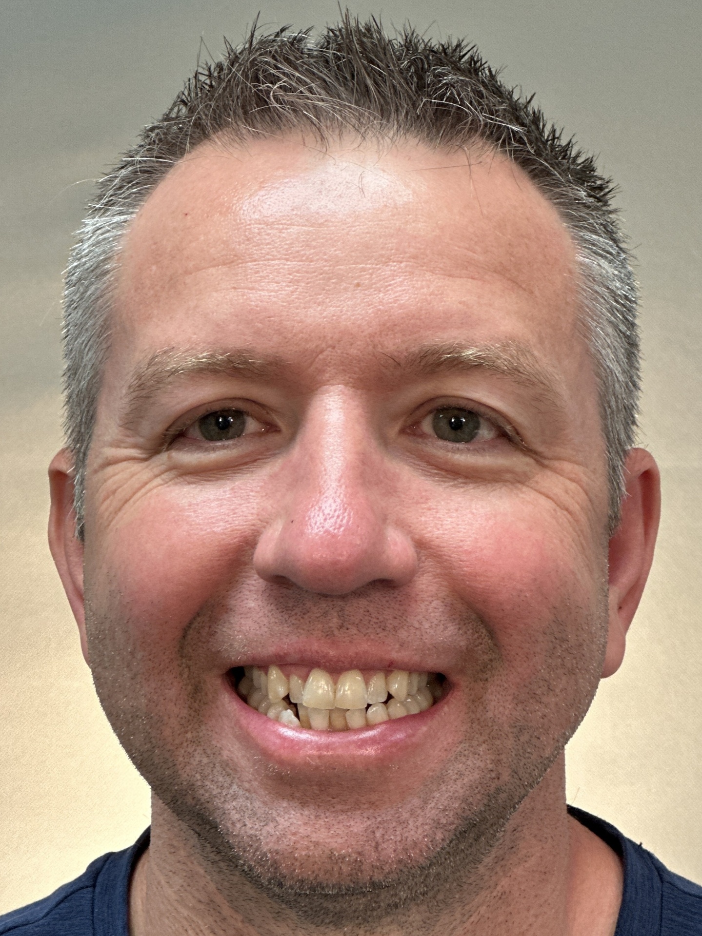 Christopher H. smile before treatment at Red Lion Dental