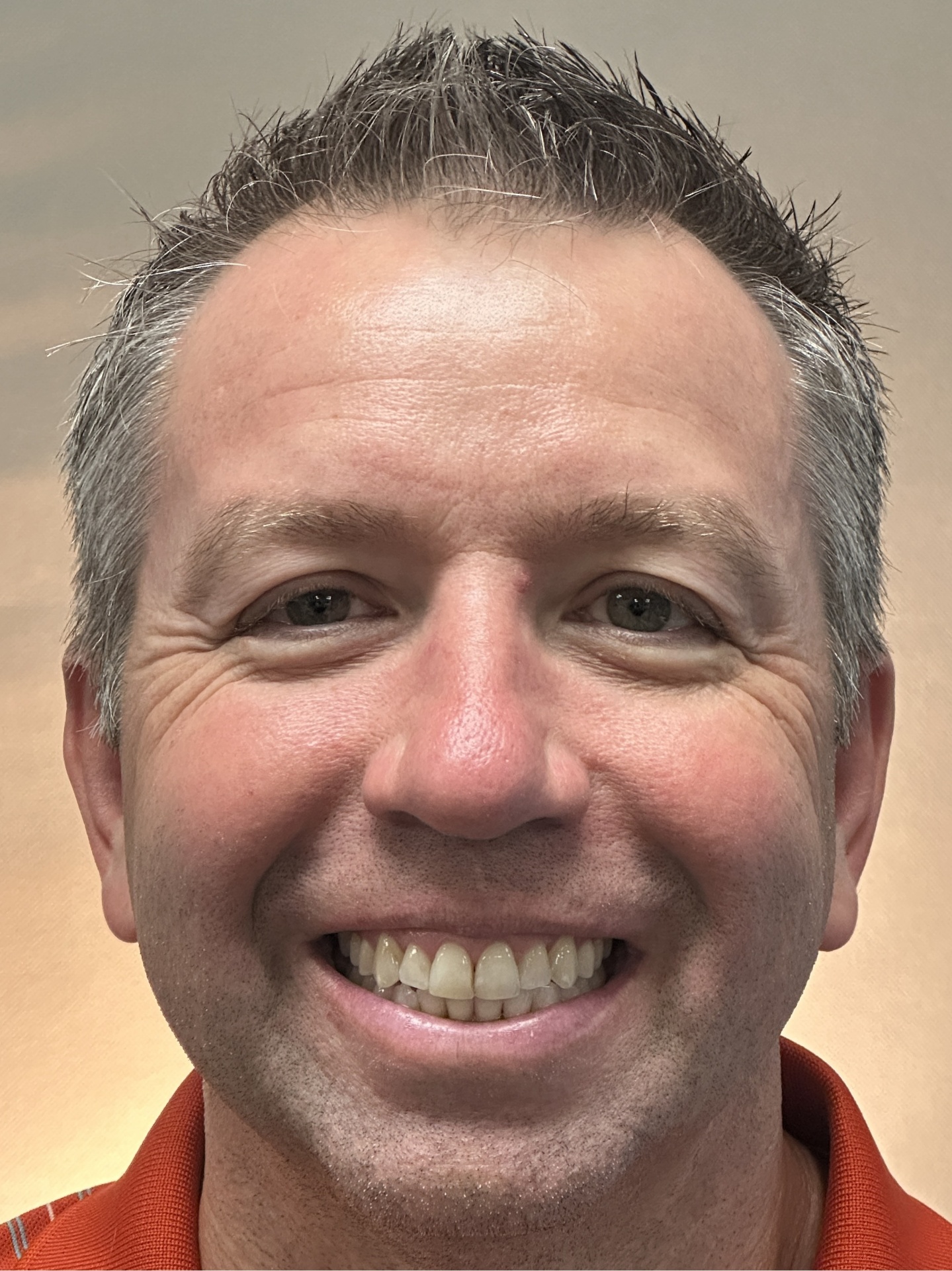 Christopher H. smile after treatment at Red Lion Dental
